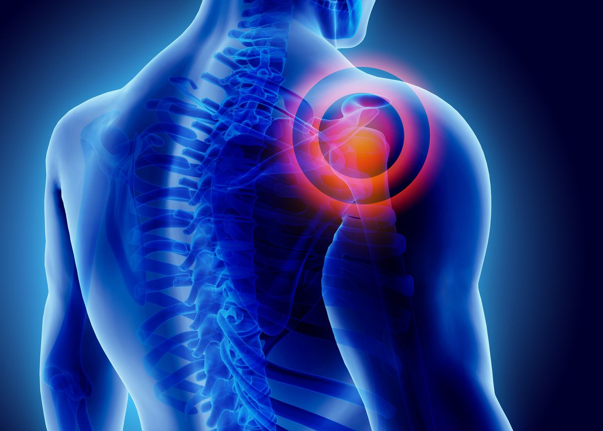 pain management